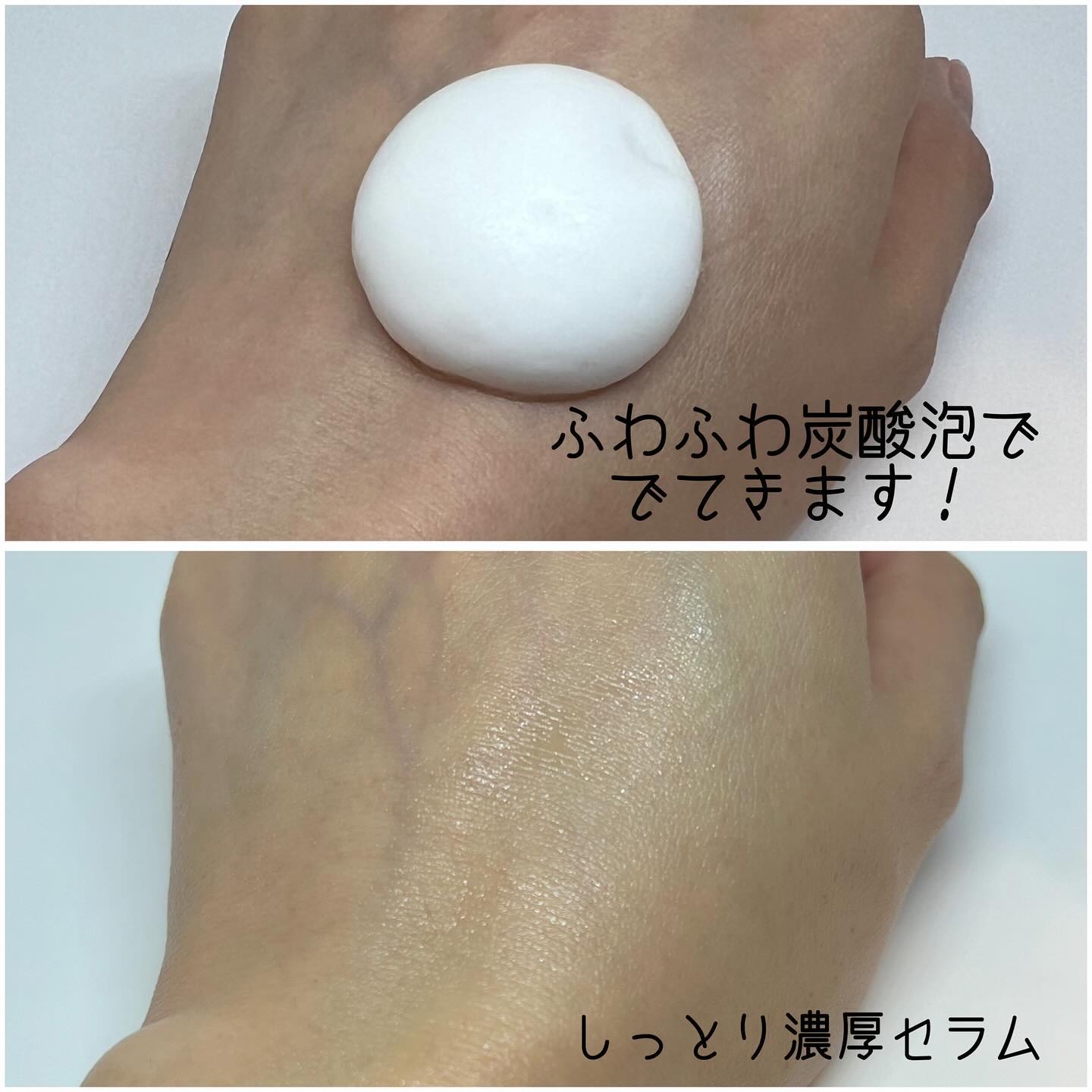 マイクロバブルVC10セラム/DSW/美容液を使ったクチコミ（2枚目）