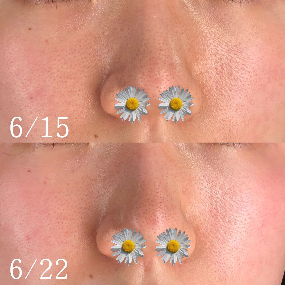 日焼け止めミルク/ママはぐ/日焼け止めミルクを使ったクチコミ（2枚目）