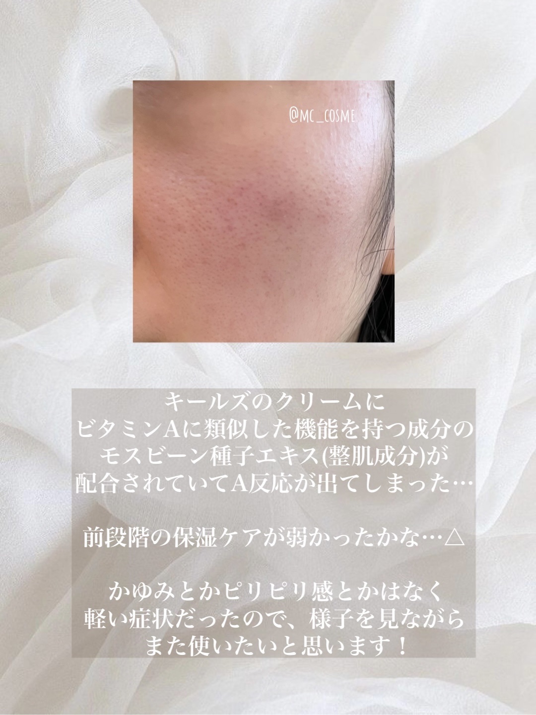 キールズ クリーム SP/Kiehl's/フェイスクリームを使ったクチコミ（2枚目）