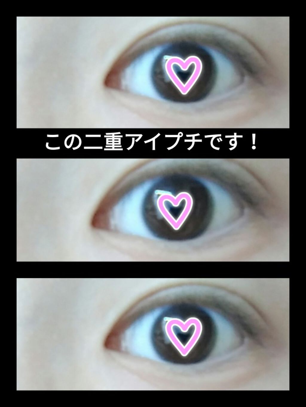 ハイブリッドフィルム/アイトーク/二重まぶた用アイテムを使ったクチコミ(1枚目)