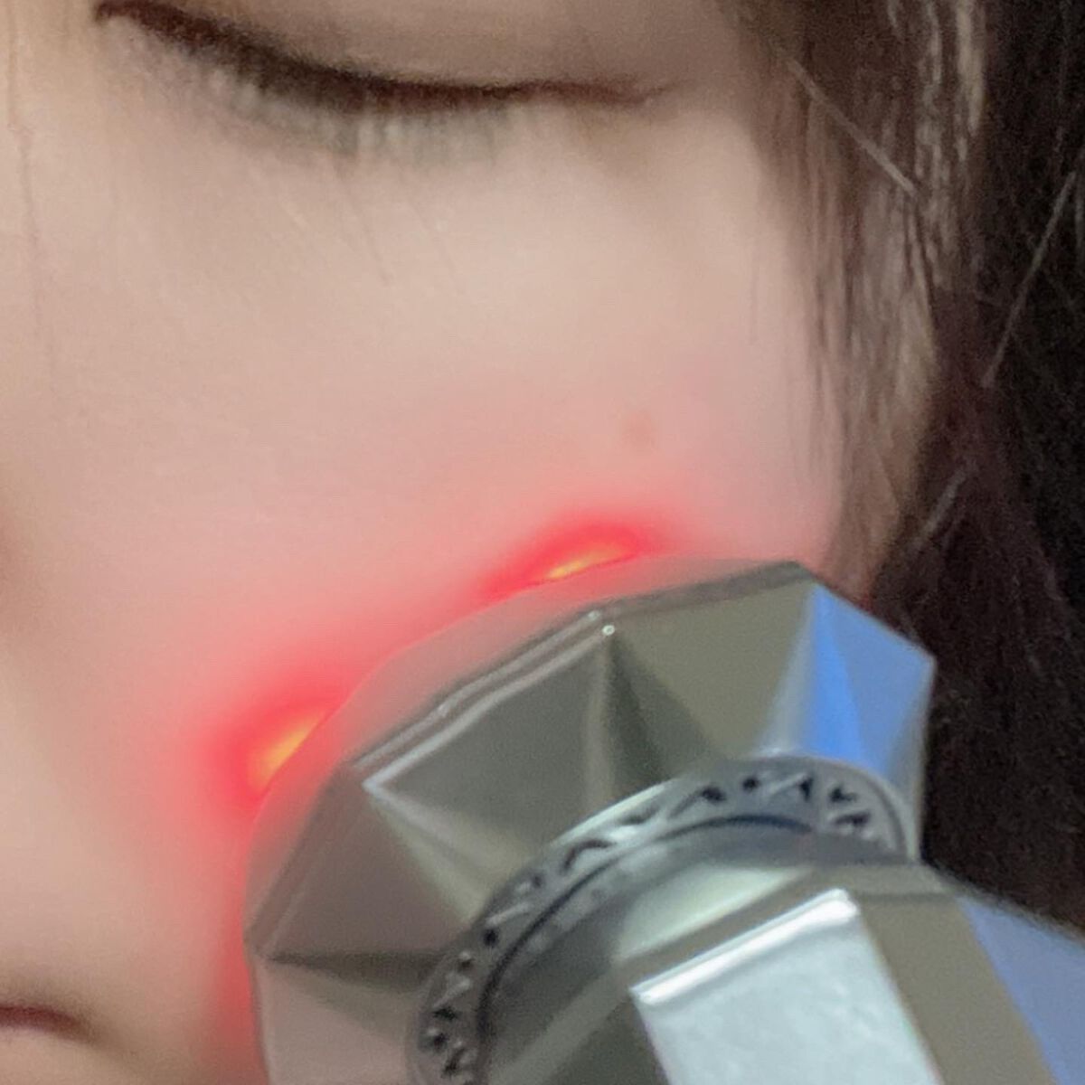 RF温冷美顔器/ANLAN/美顔器・マッサージを使ったクチコミ(2枚目)