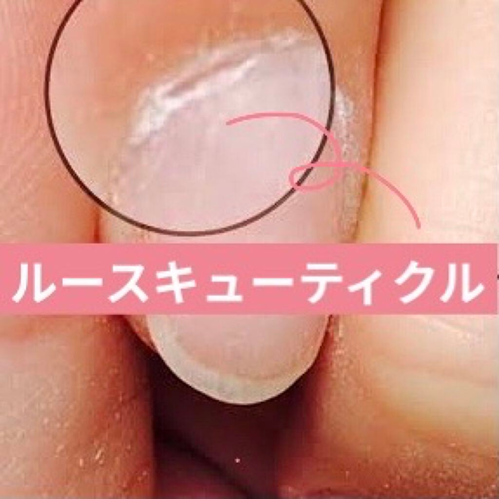 エテュセ クイックケアコート/ettusais/ネイルオイル・トリートメントを使ったクチコミ(6枚目)