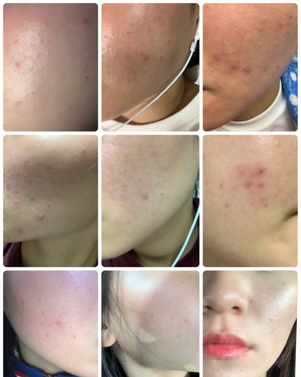 ハトムギ化粧水(ナチュリエ スキンコンディショナー R )/ナチュリエ/化粧水を使ったクチコミ（1枚目）