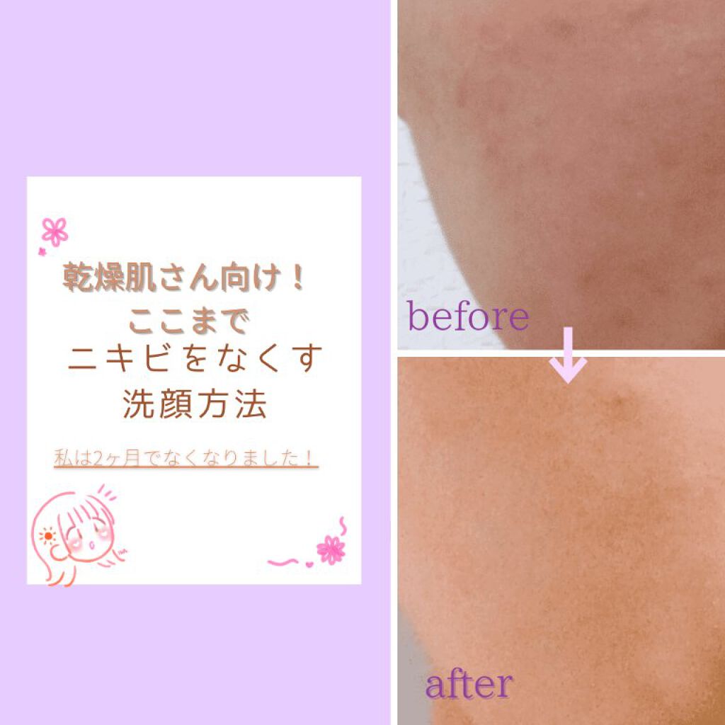 ハトムギ保湿ジェル(ナチュリエ スキンコンディショニングジェル)/ナチュリエ/美容液を使ったクチコミ（1枚目）