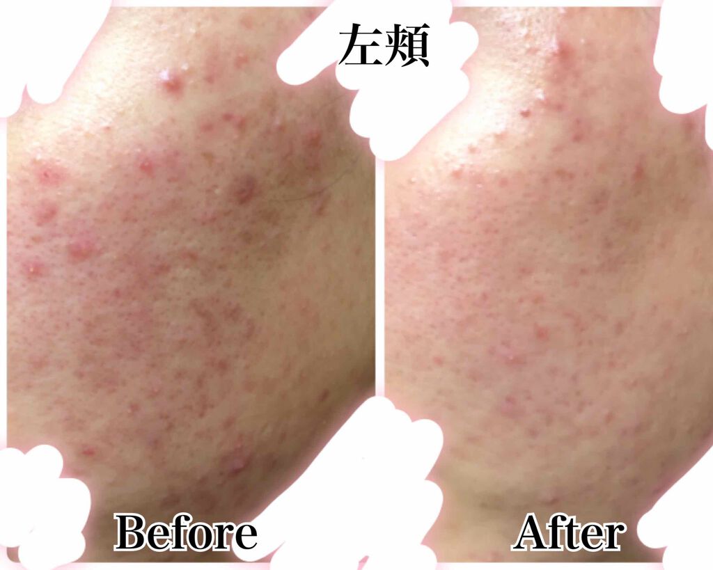 DHC マルチビタミン/DHC/美容サプリメントを使ったクチコミ（3枚目）