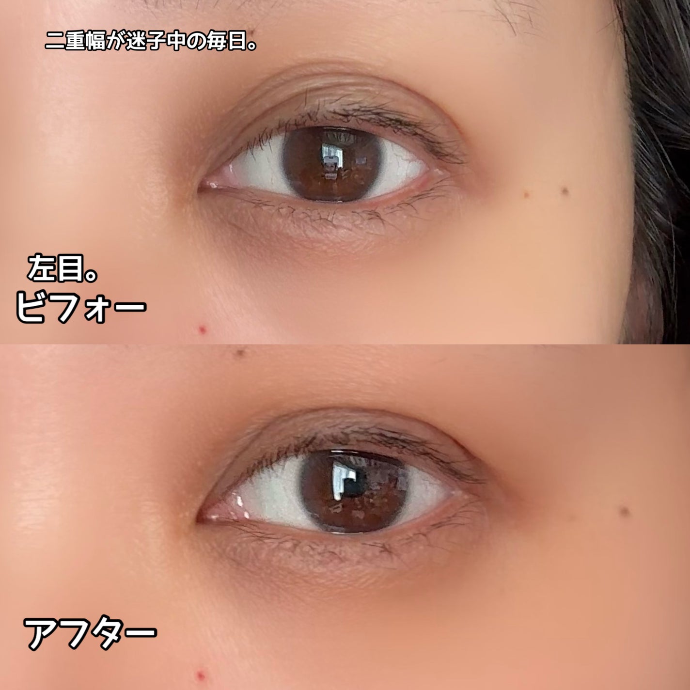メザイク クリップ カッター ファイバー専用カッター/メザイク/二重まぶた用アイテムを使ったクチコミ(6枚目)