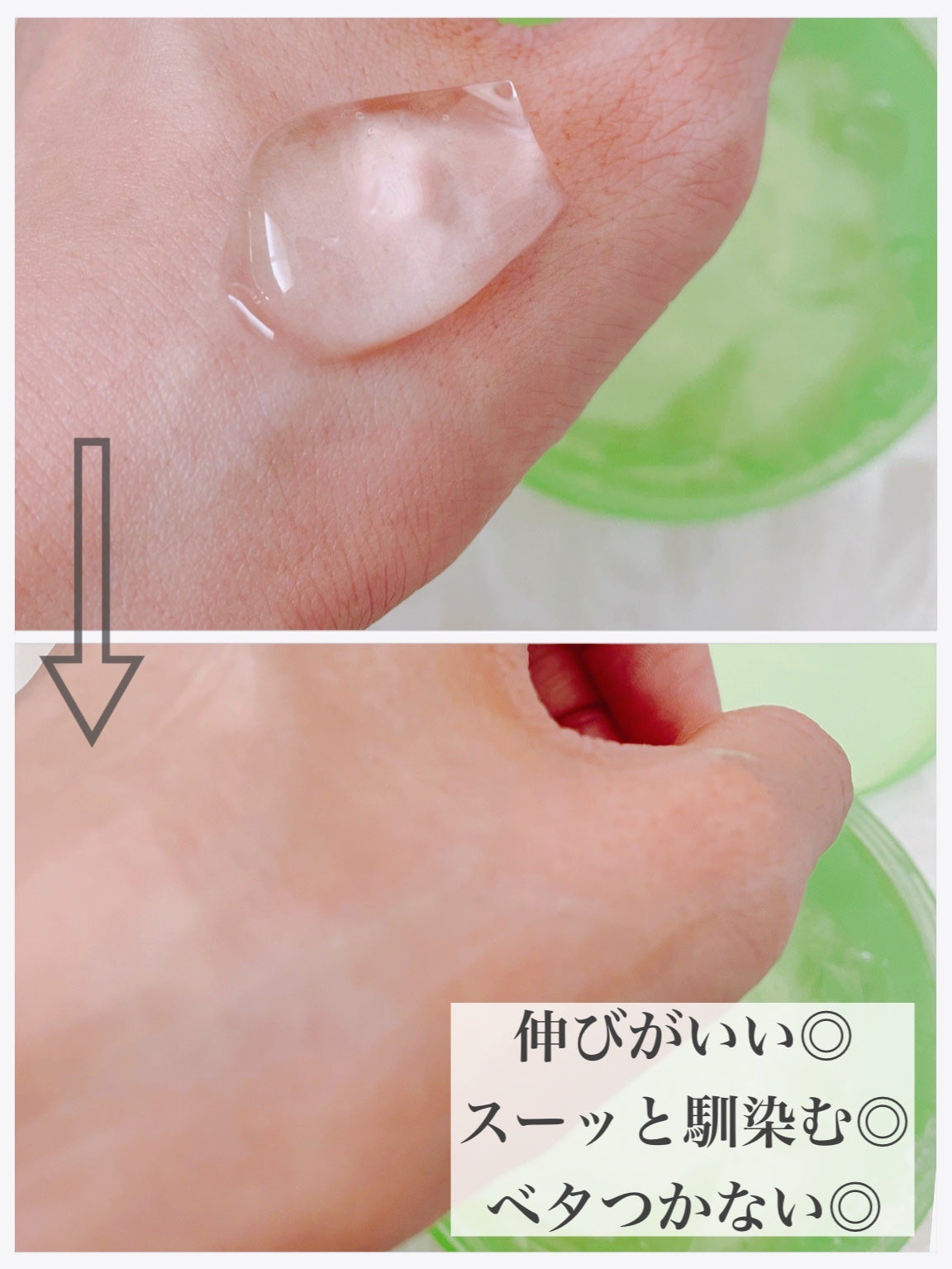 ティーツリーカーミングハイドロジェル/MEDIHEAL/ボディローションを使ったクチコミ(3枚目)