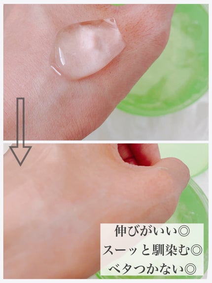 ティーツリーカーミングハイドロジェル/MEDIHEAL/ボディローションを使ったクチコミ(3枚目)