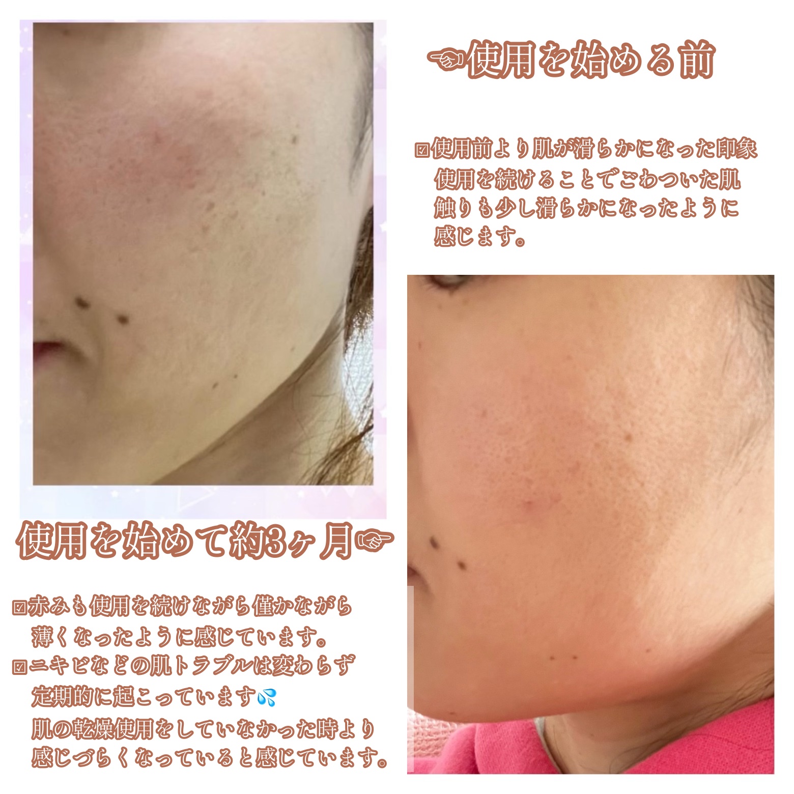 ビモラコスメ VC/BimoRa/美容液を使ったクチコミ（2枚目）