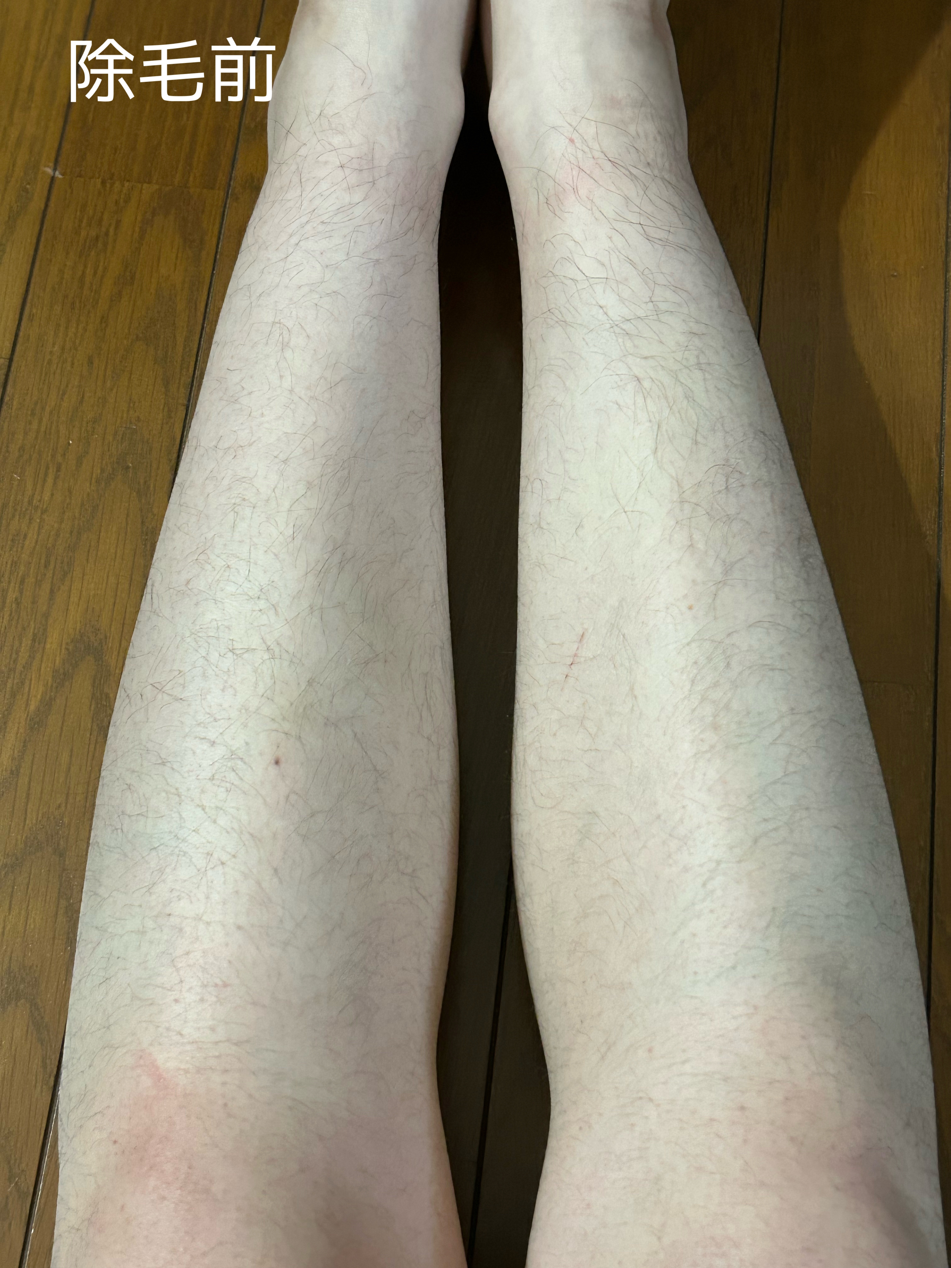 除毛クリーム リッチオイルケア/エピラット/除毛クリームを使ったクチコミ（2枚目）