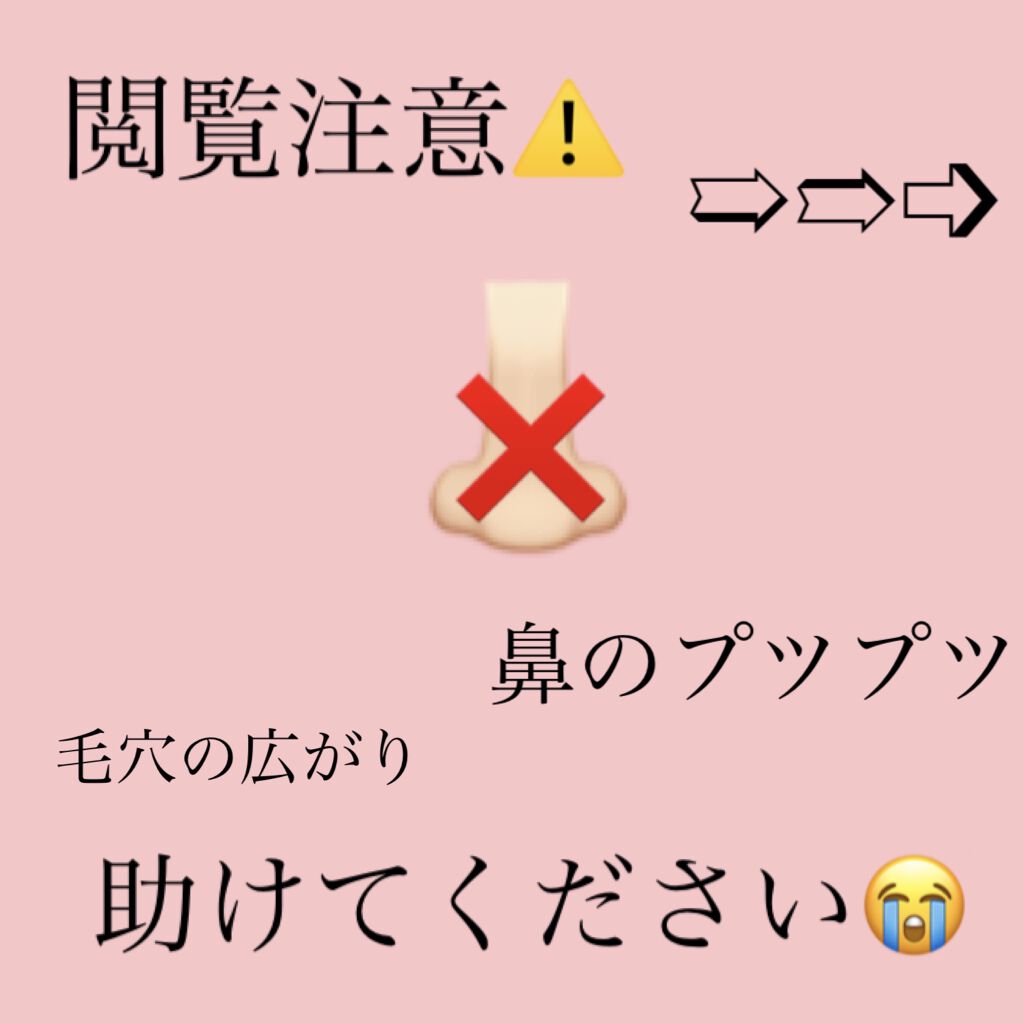 薬用 クリアローション M(しっとりタイプ)/オルビス/化粧水を使ったクチコミ（1枚目）