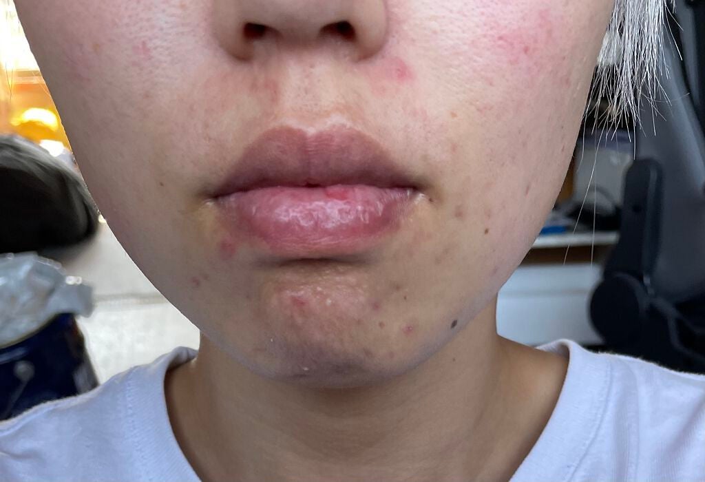 ふくぽん on LIPS 「初めまして(੭˙ᗜ˙)੭自分は肌悩みが多く、なんなら顔自体コン..」(5枚目)