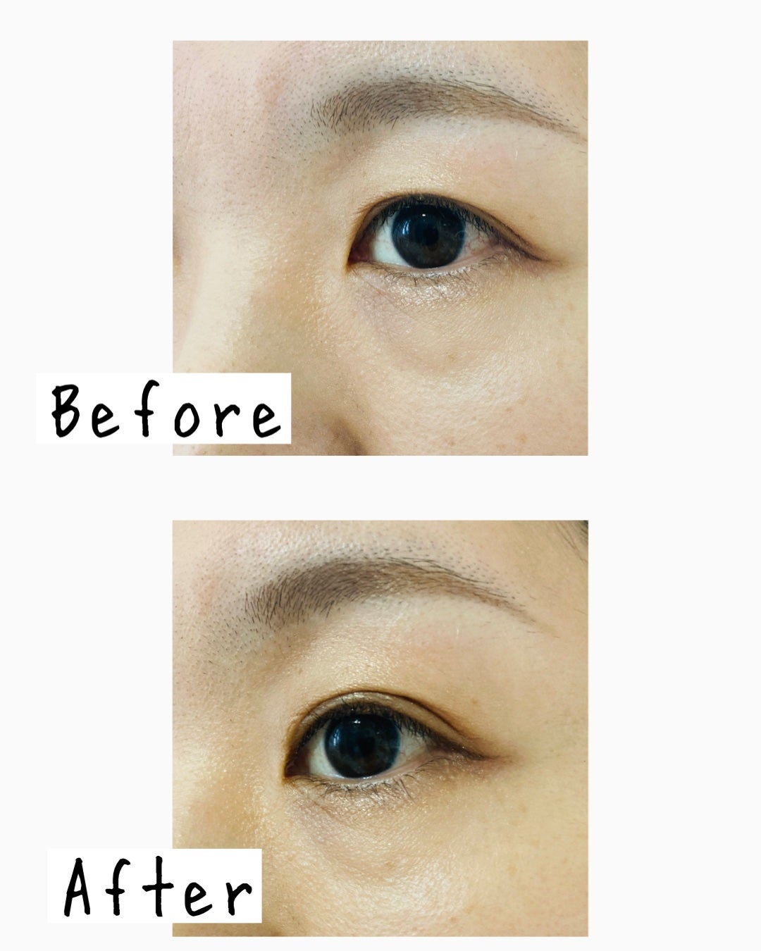 TWOOL ダブルアイリッドグルー/SHOBIDO/二重まぶた用アイテムを使ったクチコミ(5枚目)