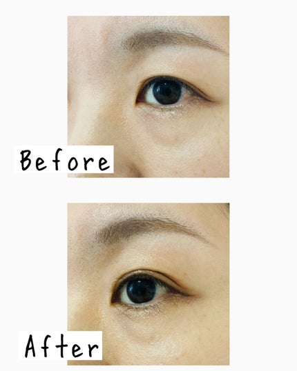 TWOOL ダブルアイリッドグルー/SHOBIDO/二重まぶた用アイテムを使ったクチコミ(5枚目)