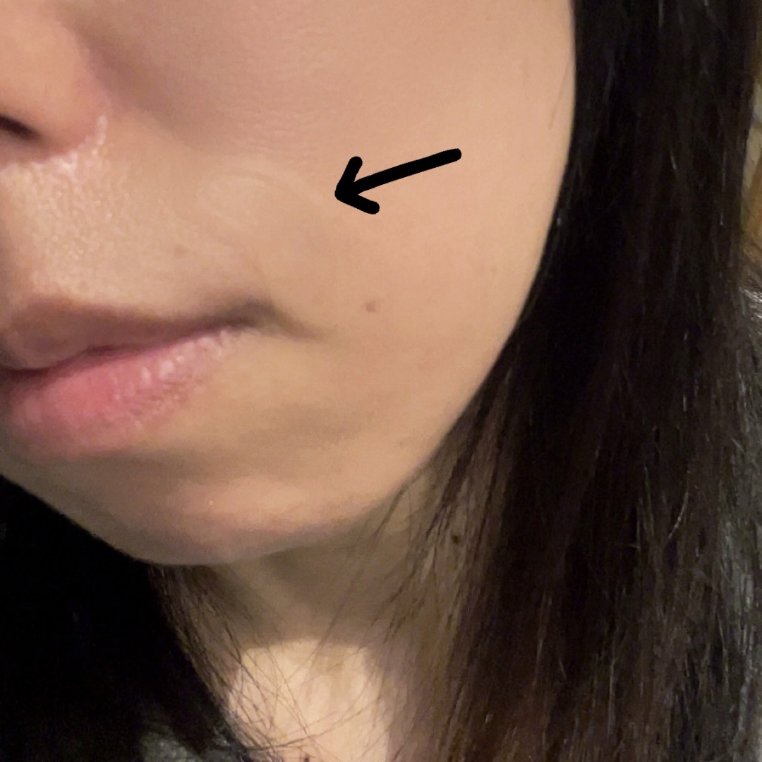 肌美精　アイバッグ　ニードルショット/肌美精/アイケア・アイクリームを使ったクチコミ（3枚目）