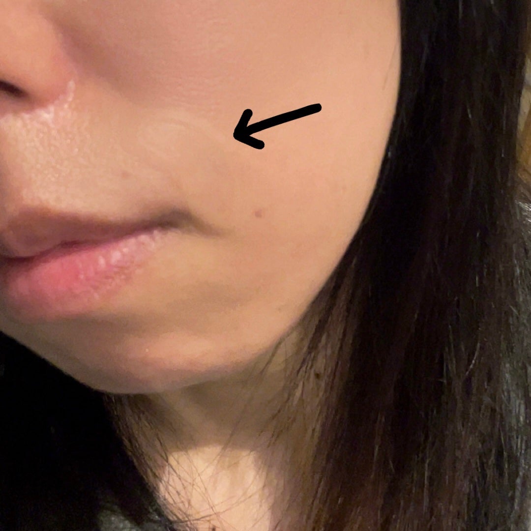 肌美精 アイバッグ ニードルショット/肌美精/アイケア・アイクリームを使ったクチコミ(3枚目)