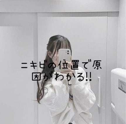 Chitose♪ on LIPS 「ニキビ位置で原因がわかる!!みなさんはニキビの位置で原因がわか..」(1枚目)