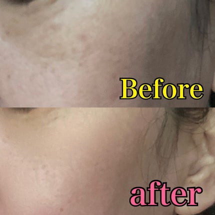 カラーチェンジファンデーション/QUEI/クリーム・エマルジョンファンデーションを使ったクチコミ(6枚目)