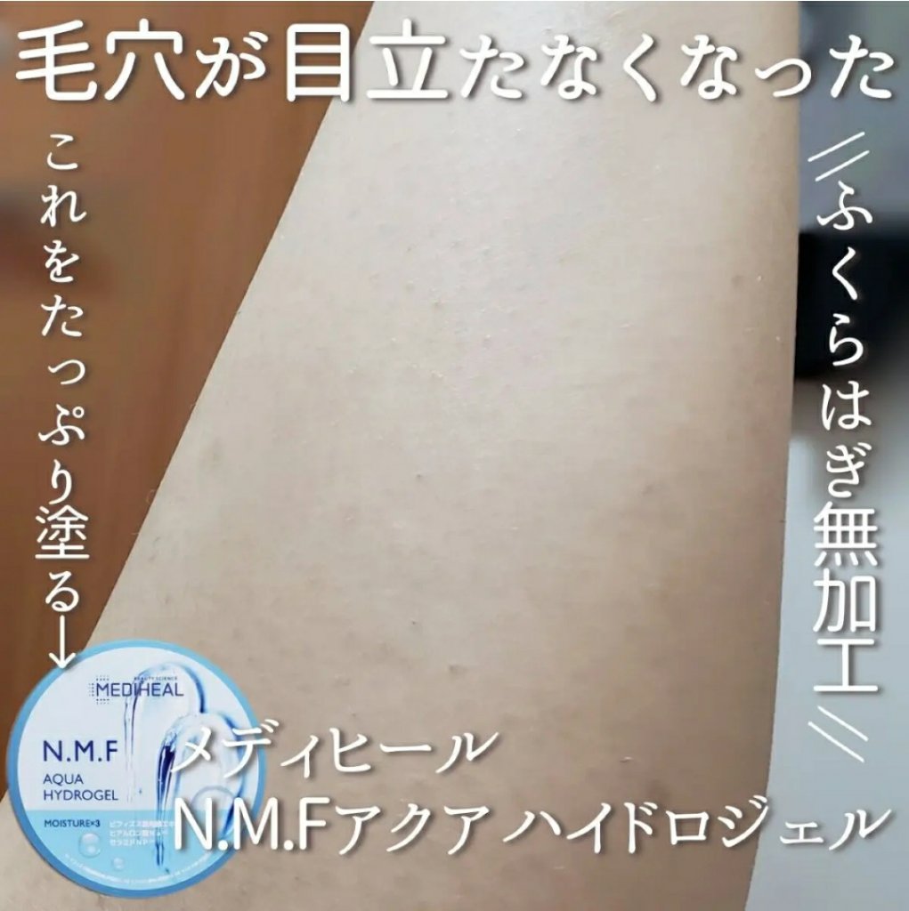 N.M.Fアクアハイドロジェル/MEDIHEAL/ボディローションを使ったクチコミ（3枚目）