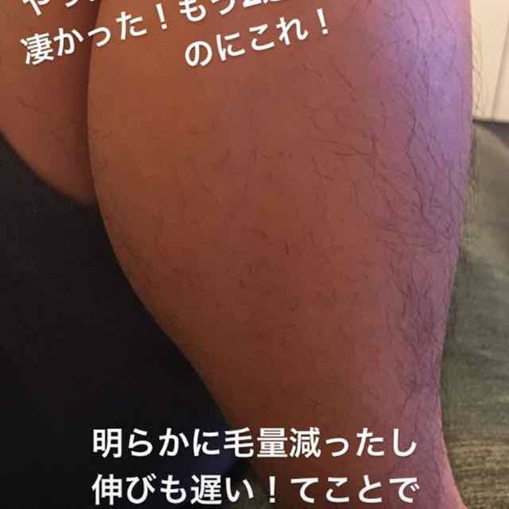 脱毛クリーム MOOMO/自然化粧品研究所/除毛クリームを使ったクチコミ（3枚目）