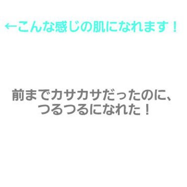 ハトムギ化粧水(ナチュリエ スキンコンディショナー R )/ナチュリエ/化粧水を使ったクチコミ（3枚目）