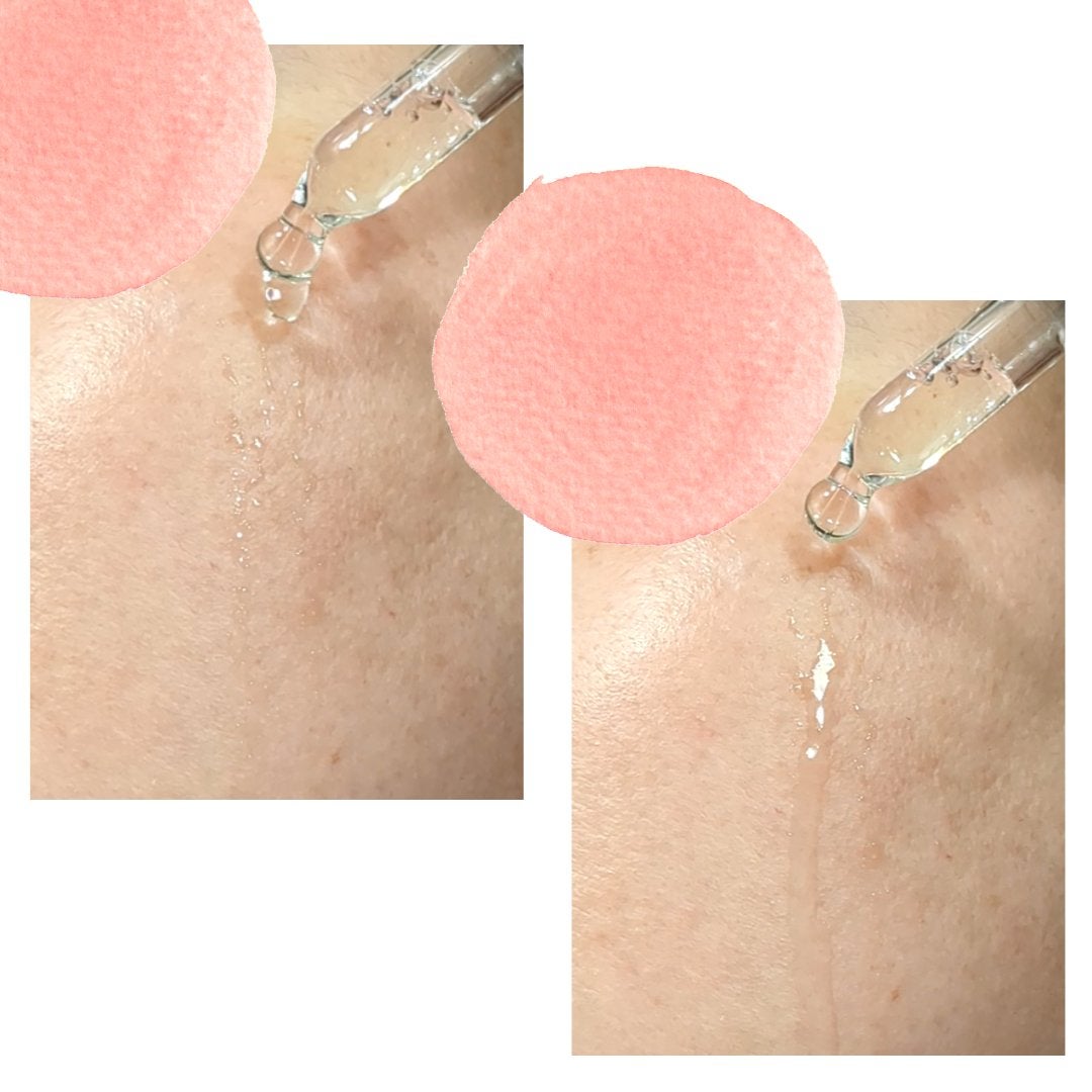 タカミスキンピール/タカミ/ブースター・導入液を使ったクチコミ(4枚目)