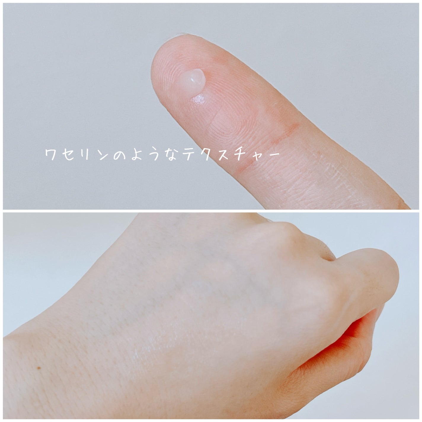 HQ セラム/ダーマセプトRX/美容液を使ったクチコミ(5枚目)