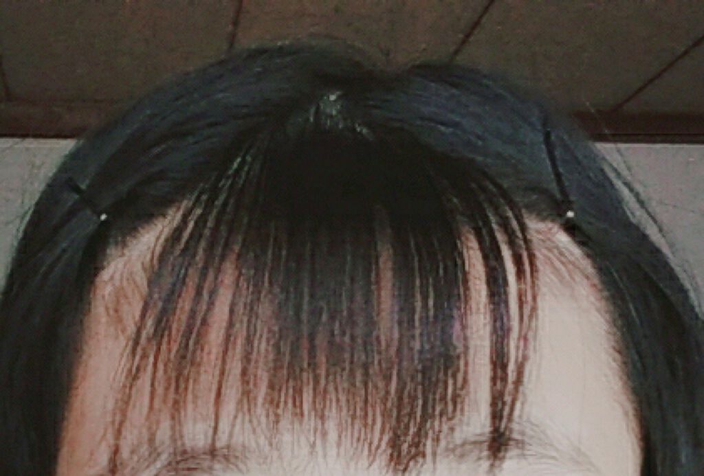 あちょぱ on LIPS 「あちょぱです!シースルーの仕方が分からないので、コメントで教え..」(2枚目)