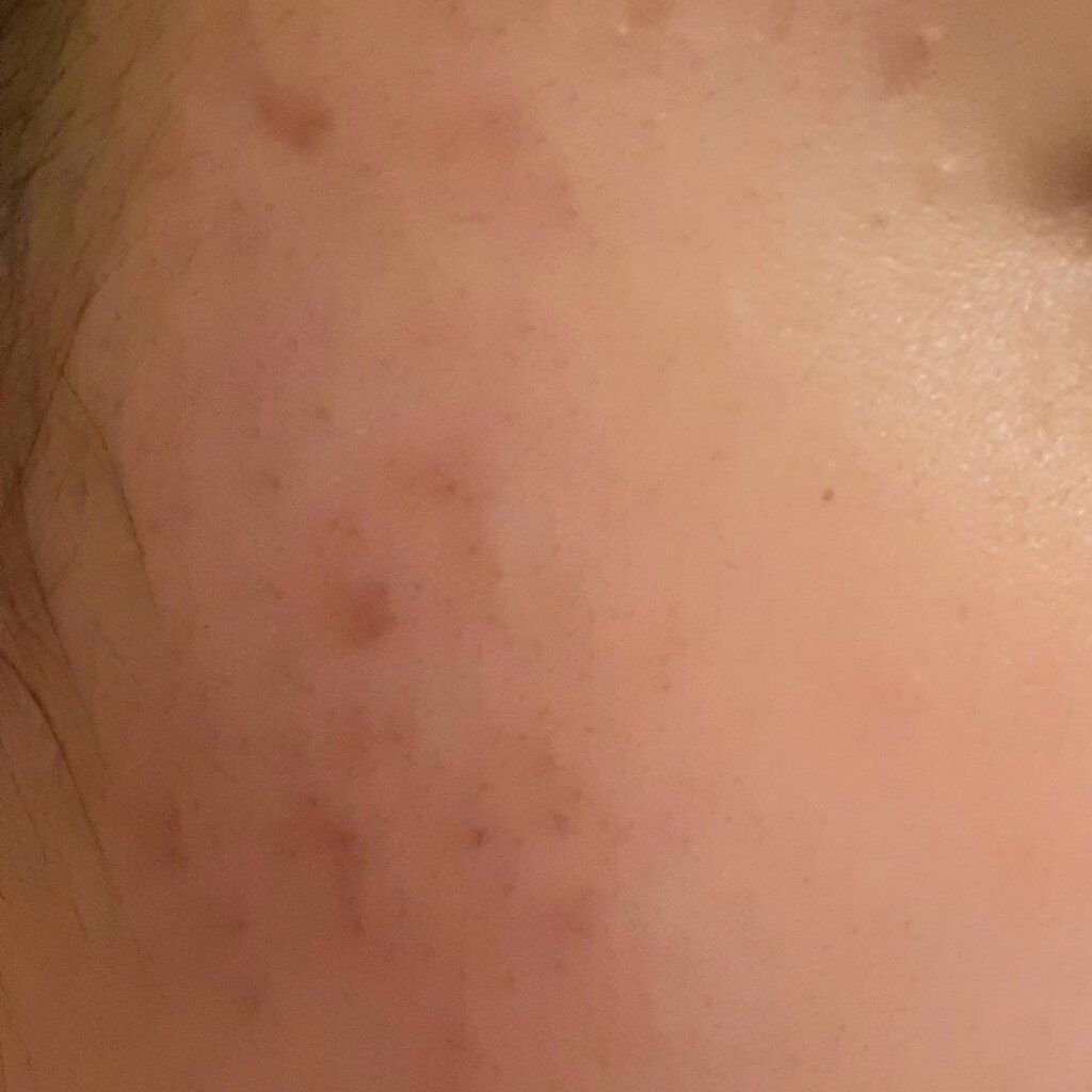 ドクダミ 77 スージングトナー/Anua/化粧水を使ったクチコミ（2枚目）