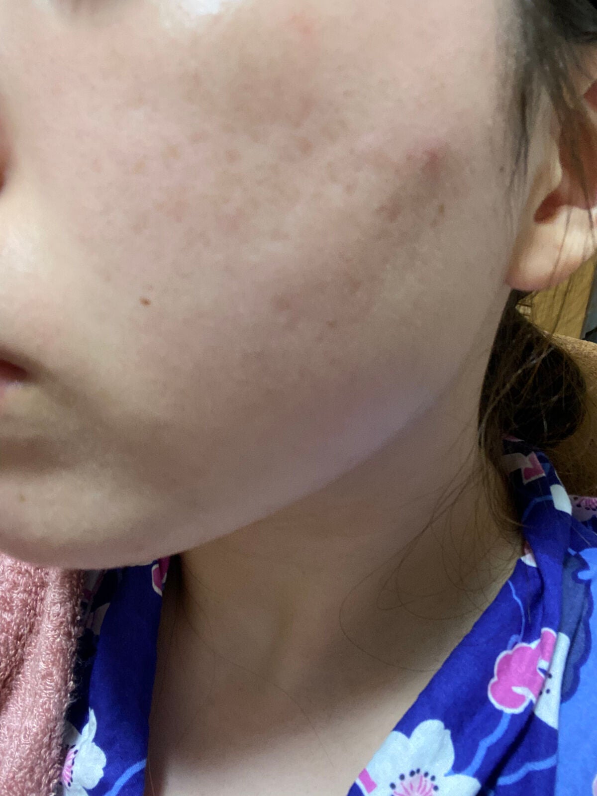 マリンに恋して/ラッシュ/その他洗顔料を使ったクチコミ(4枚目)