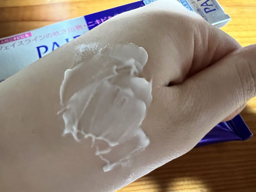 ペアアクネクリームW(医薬品)/ペア/その他を使ったクチコミ（2枚目）