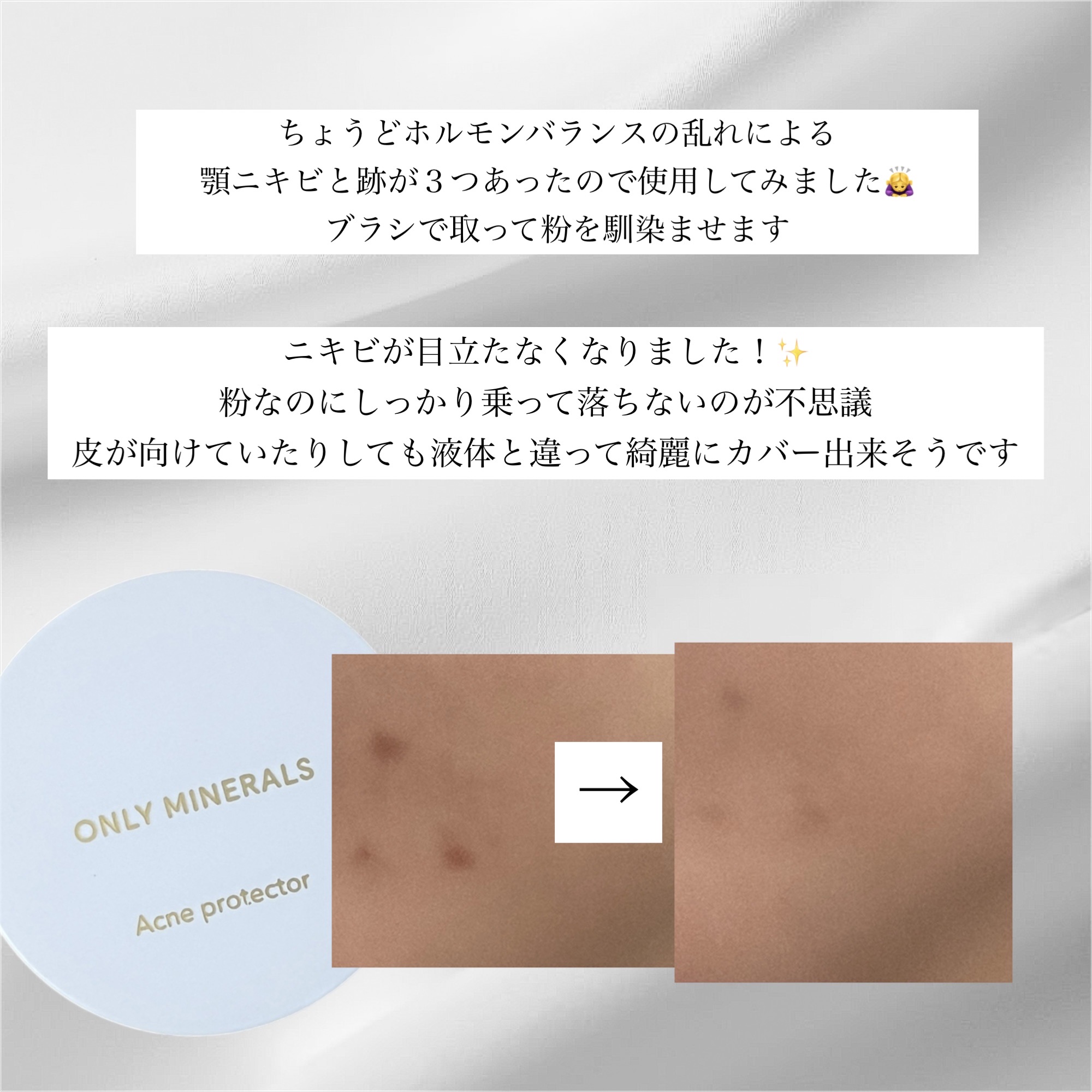 薬用コンシーラー アクネプロテクター/ONLY MINERALS/パウダーコンシーラーを使ったクチコミ（3枚目）