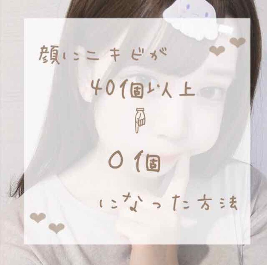 DHC ビタミンBミックス/DHC/美容サプリメントを使ったクチコミ(1枚目)