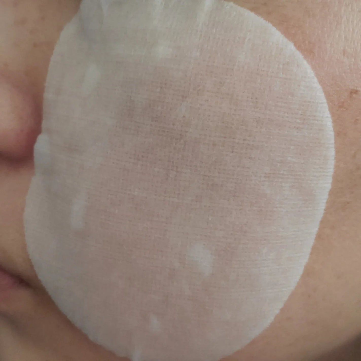 シカテロル スポットマスクパッド/beplain/トナーパッドを使ったクチコミ(5枚目)
