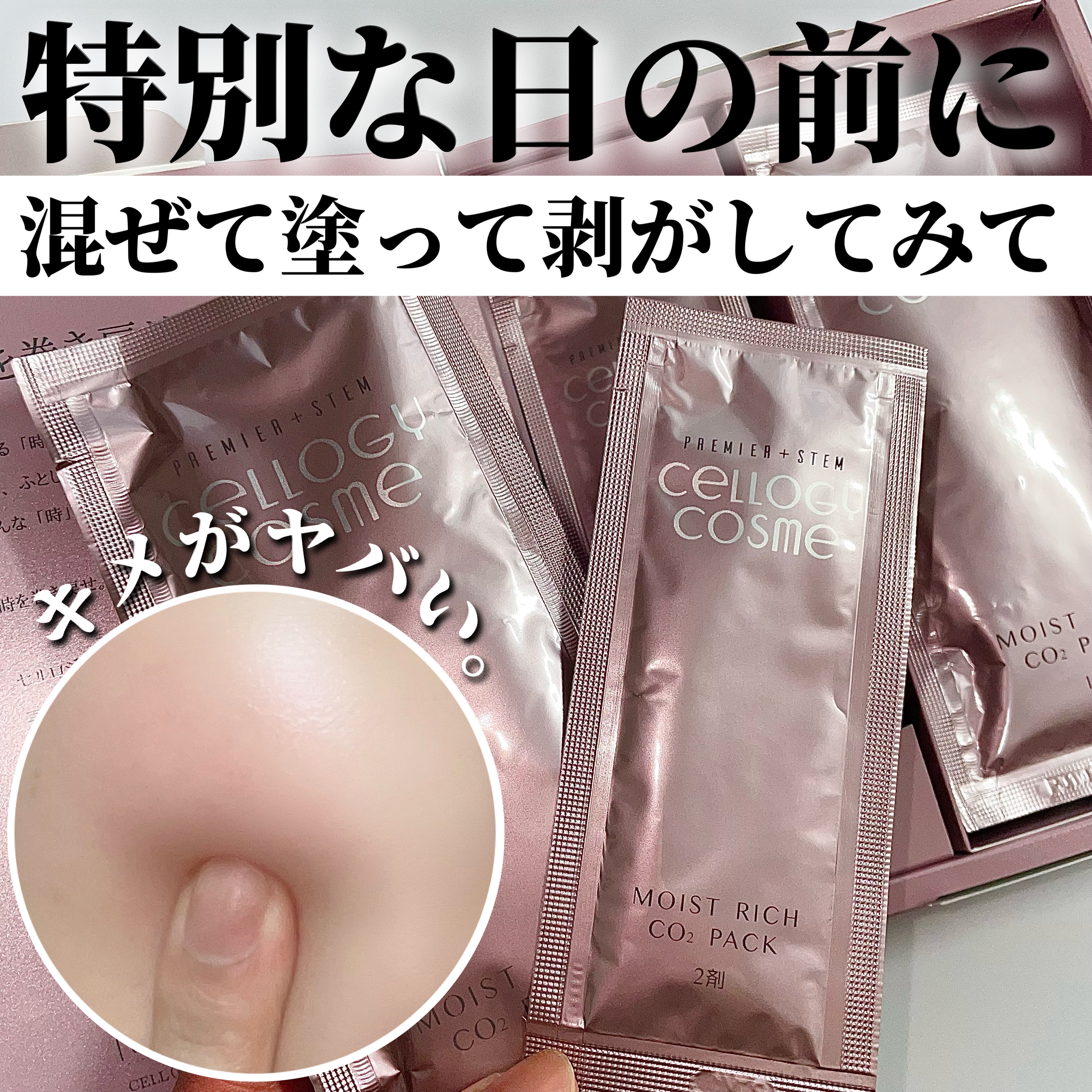 モイストリッチ炭酸パック/セルロジーコスメ/シートマスク・パックを使ったクチコミ（1枚目）