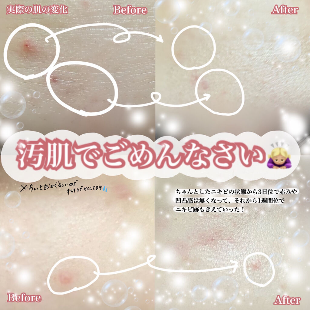 スーパーシカクリーム/MEDICUBE/フェイスクリームを使ったクチコミ（3枚目）