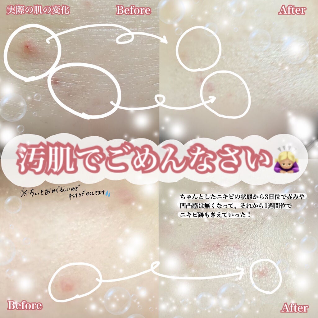 スーパーシカトナー/MEDICUBE/化粧水を使ったクチコミ(3枚目)