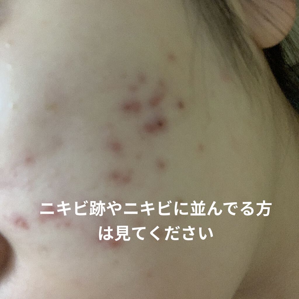 シーバム クリーン ウォーター ACモイスト/ACSEINE/化粧水を使ったクチコミ（1枚目）