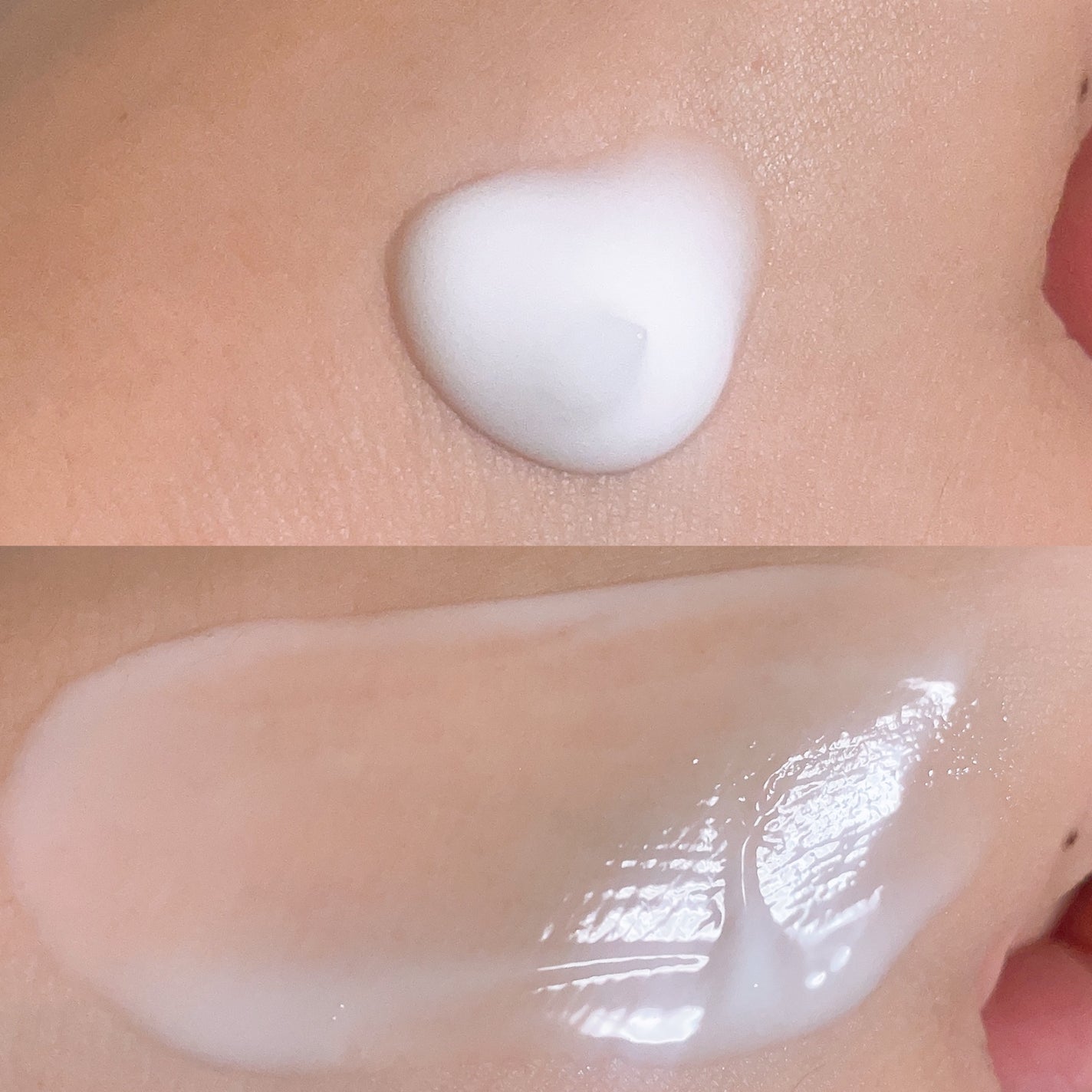 ミノン アミノモイスト 薬用アクネケア ローション/ミノン/化粧水を使ったクチコミ(5枚目)