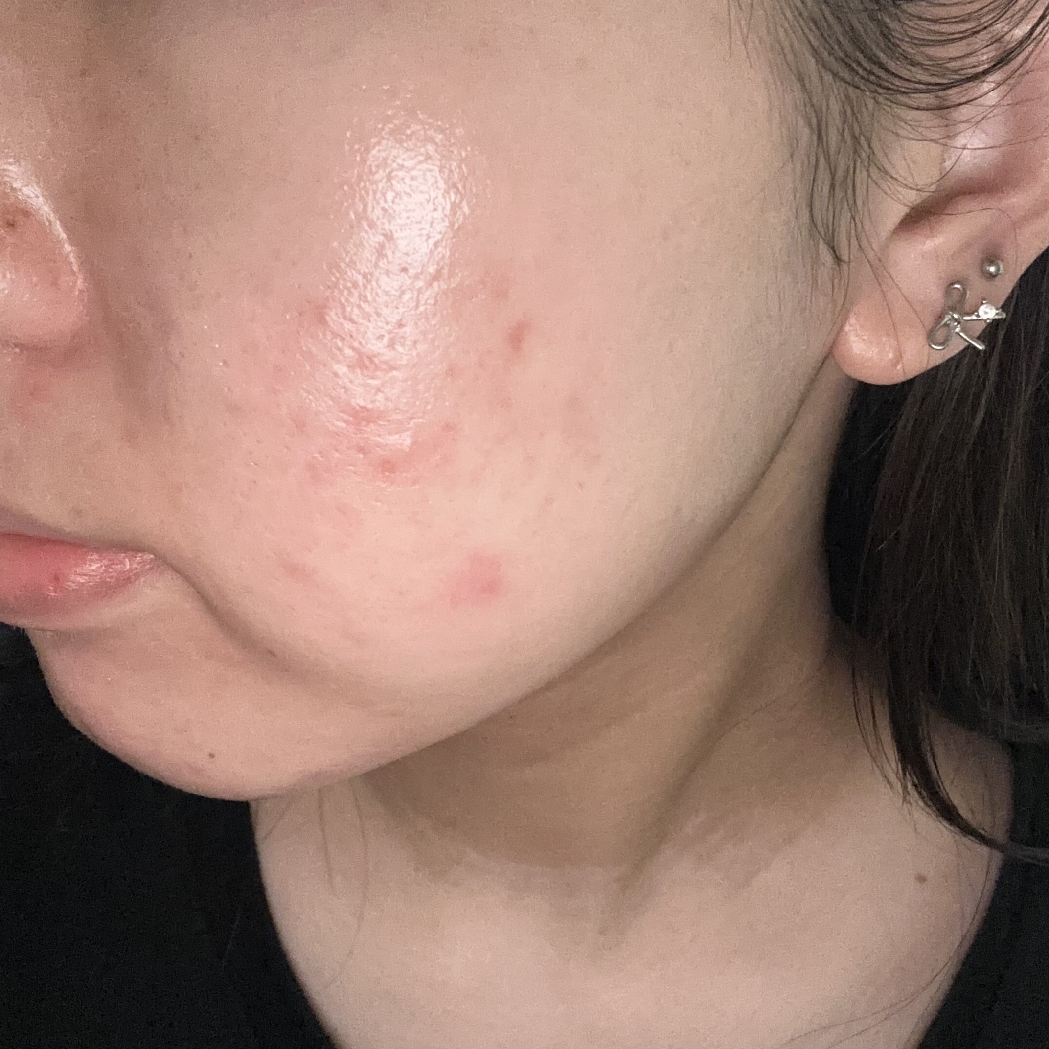 潤浸保湿 乳液/キュレル/乳液を使ったクチコミ（1枚目）