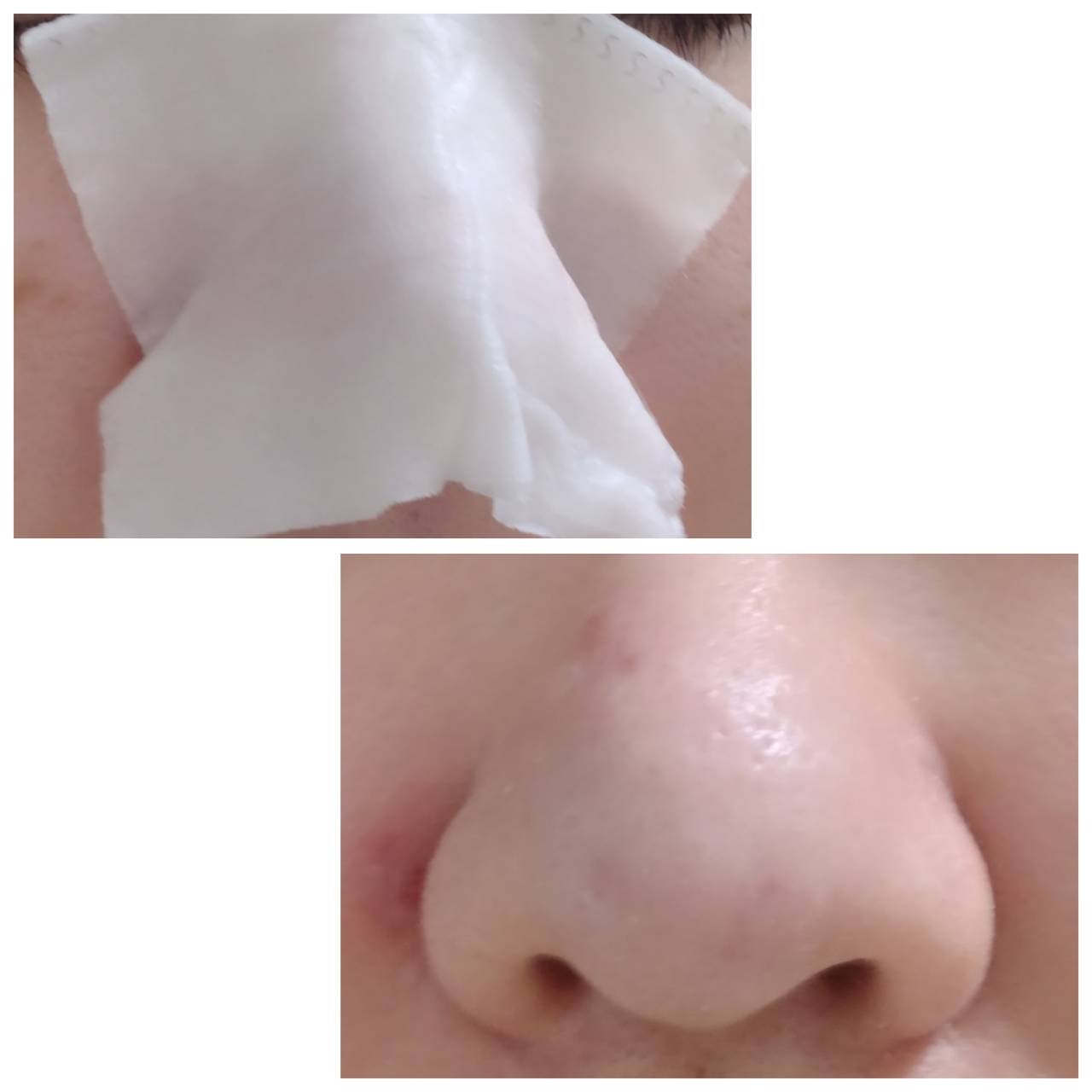 スキンコンディショナー/シェルミラック/頭皮ケアを使ったクチコミ(4枚目)