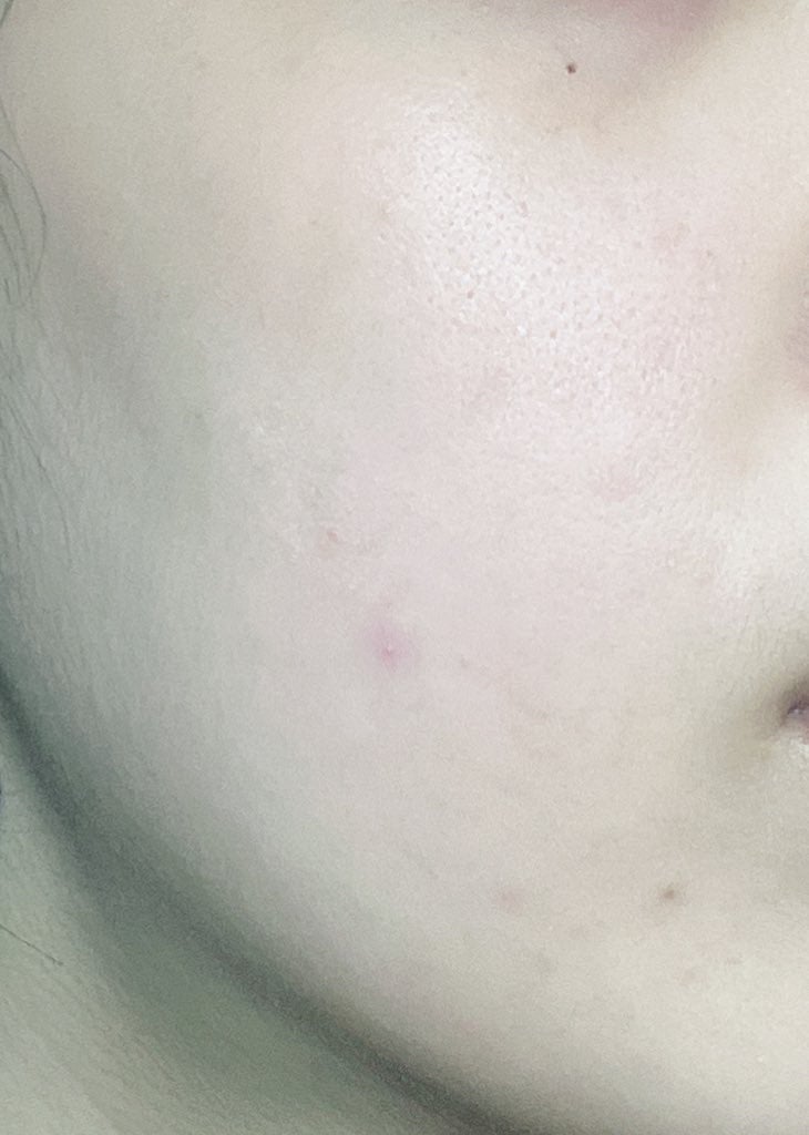 RMK Wトリートメントオイル/RMK/ブースター・導入液を使ったクチコミ(2枚目)