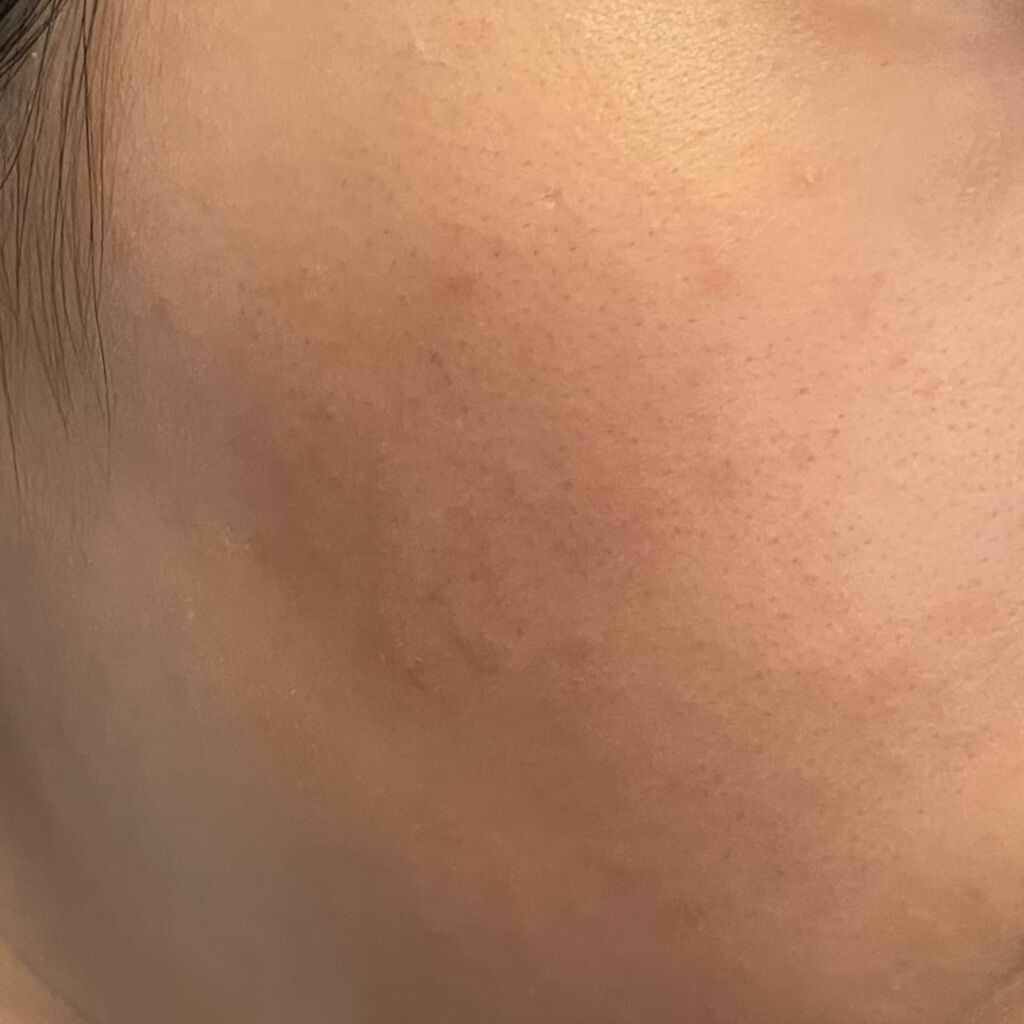 薬用固形パウダー/ピジョン/ボディパウダーを使ったクチコミ（2枚目）