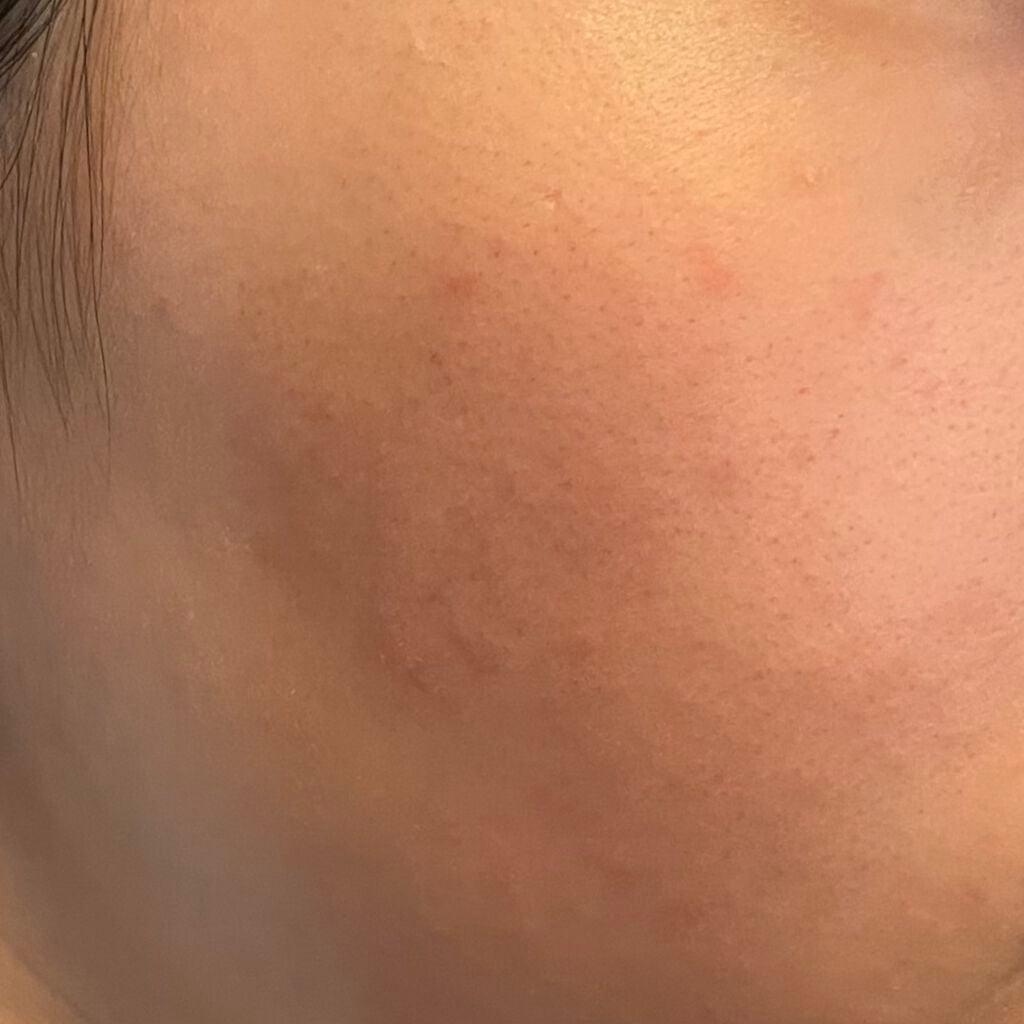 薬用固形パウダー/ピジョン/ボディパウダーを使ったクチコミ(2枚目)