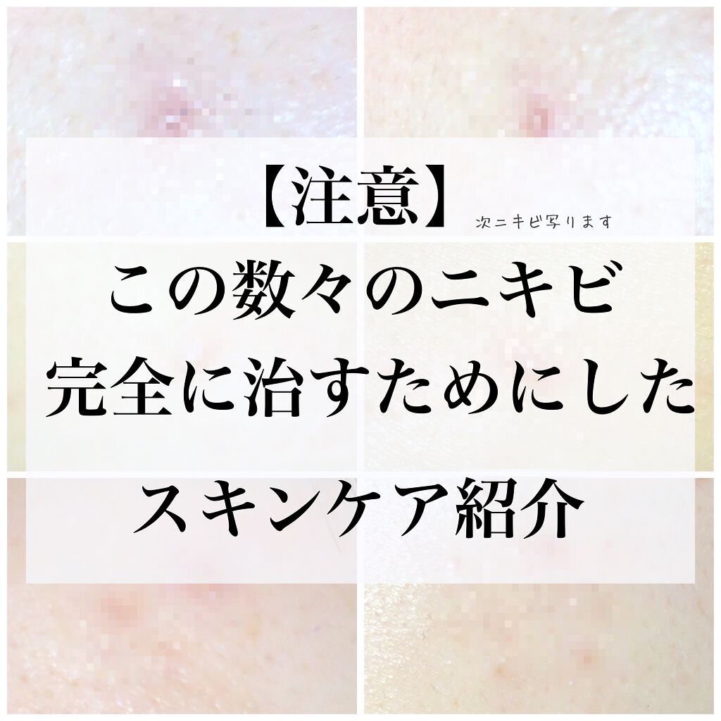 潤浸保湿 フェイスクリーム/キュレル/フェイスクリームを使ったクチコミ（1枚目）