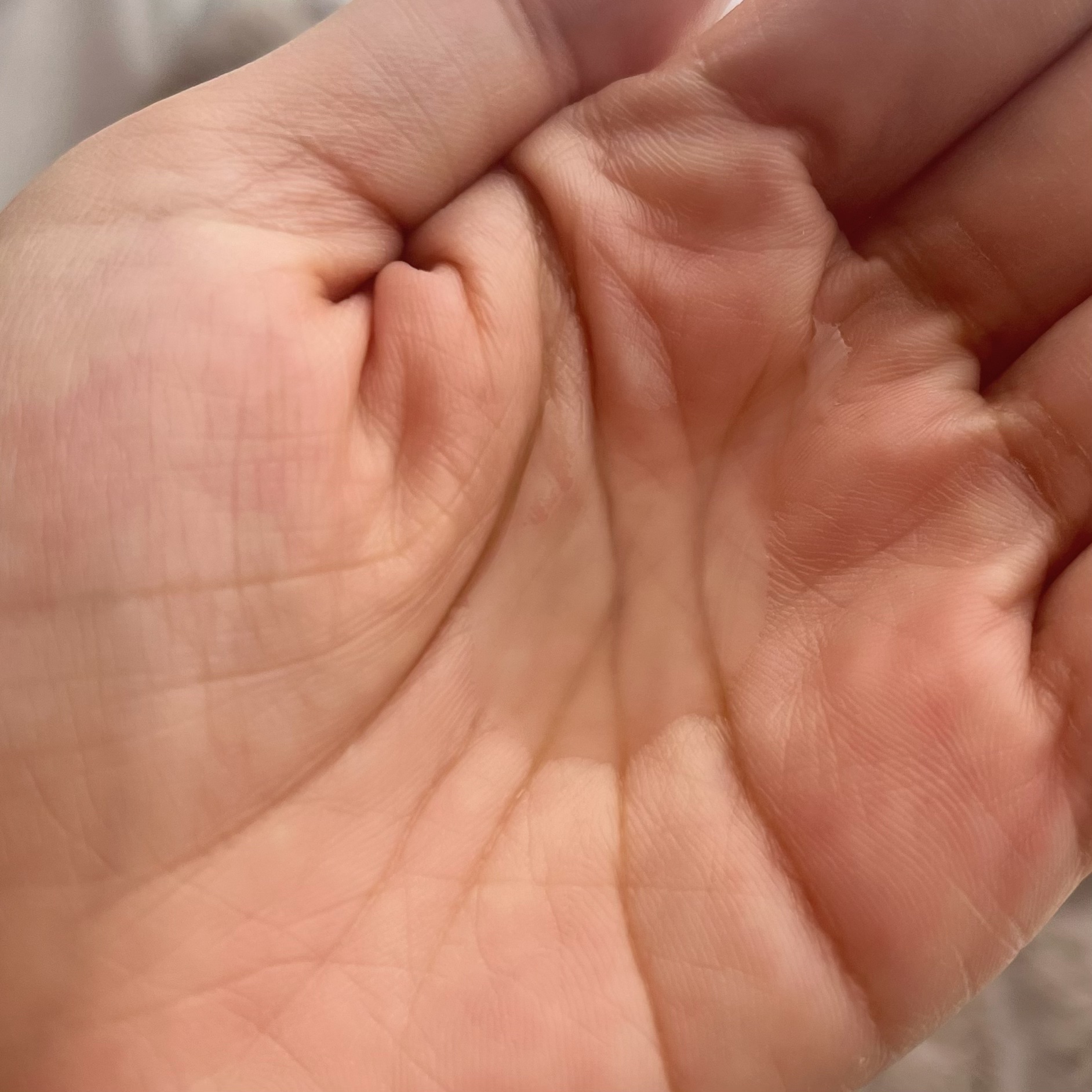  オールカーミングトナー /Easydew/化粧水を使ったクチコミ（2枚目）