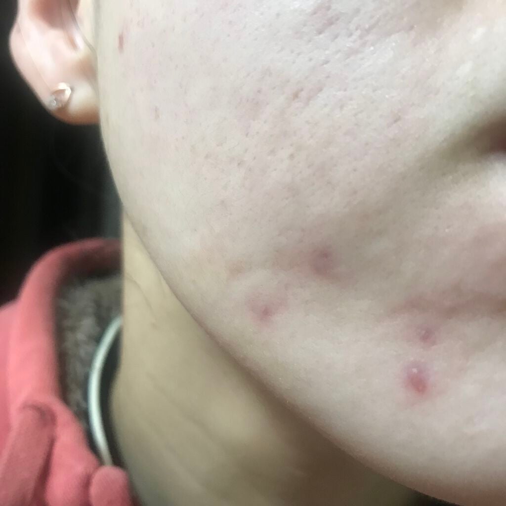 レチノールA 1% アドバンスドリバイタリゼーションクリーム/Life-flo/フェイスクリームを使ったクチコミ(2枚目)