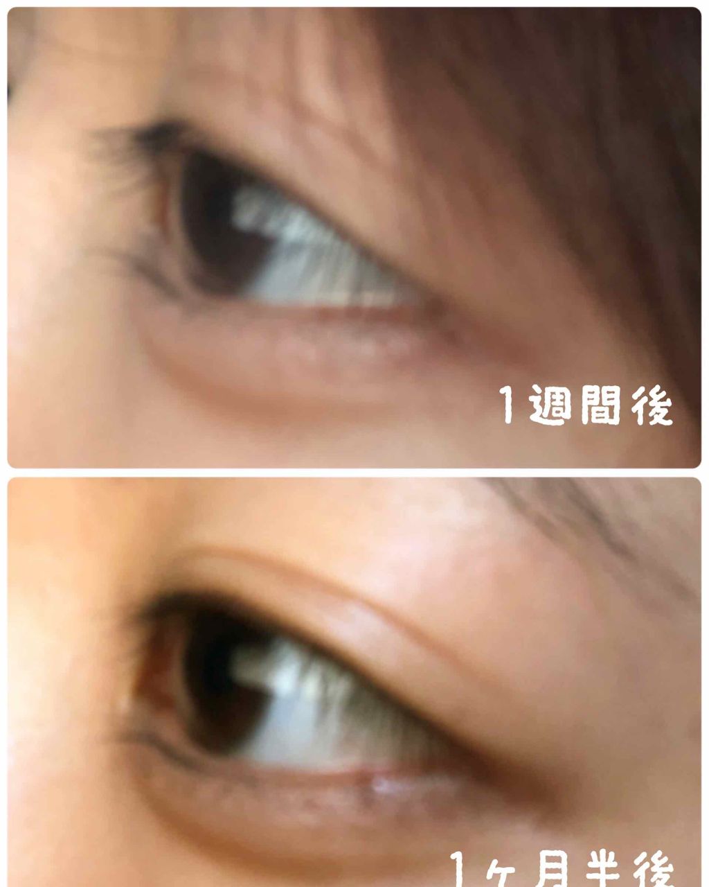 D濃密美容液 ローヤルゼリー/DAISO/美容液を使ったクチコミ(3枚目)