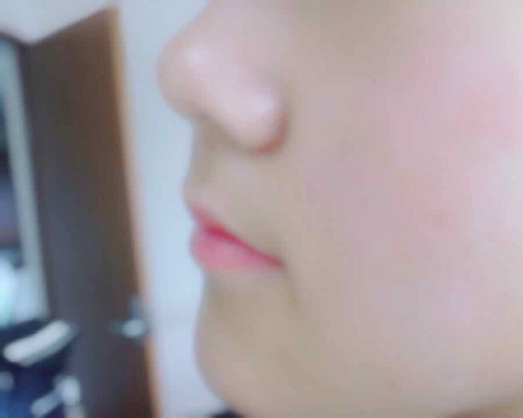 ãŠã³ãðð on LIPS ãçããã§ããã ãå®ãç°¡åã«çŸçœã«ãªãããã§ãããïŒã§ãå°åŠçã..ãïŒ4æç®ïŒ