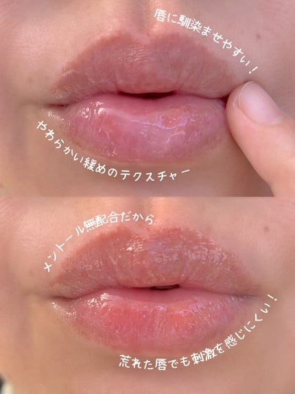 メディカルリップnc(医薬品)/メンソレータム/その他を使ったクチコミ(4枚目)